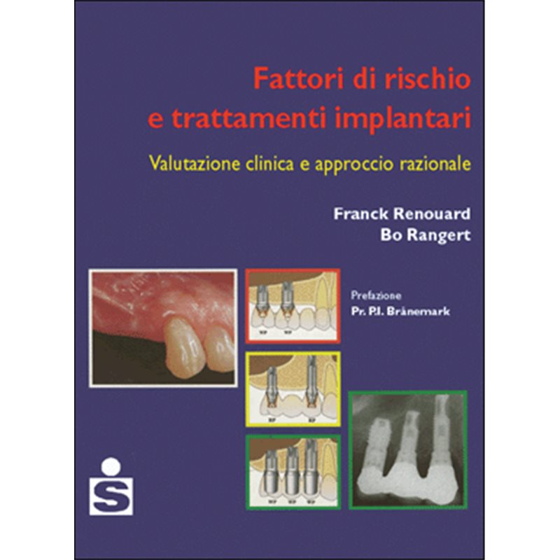 Fattori di rischio e trattamenti implantari